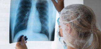 Может быть без кашля: пульмонолог Литасова назвала особенности «немой» пневмонии